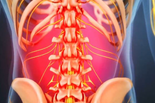 back-muscle-spasms-symptoms-causes-and-treatments-southeast-pain