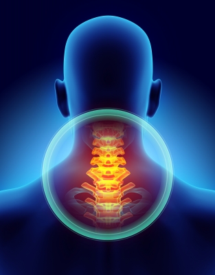 3 Things That Cause Your Neck Pain